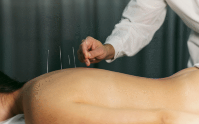 Best Acupuncture Clinics in Galway